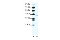 ZNF312 Rabbit anti-Human, Polyclonal, Novus Biologicals 0.1 mL; Unconjugated:Antibodies,